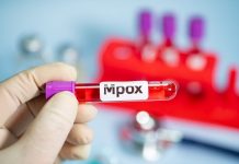 Ministério da Saúde alerta para os casos de Mpox no Brasil